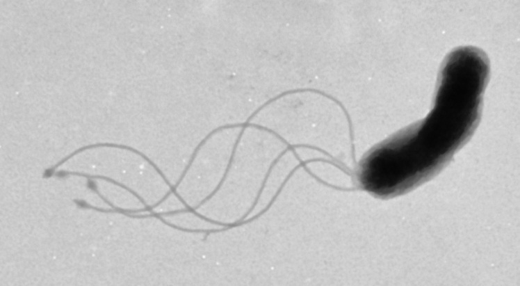 electron micrograph of Helicobacter pylori