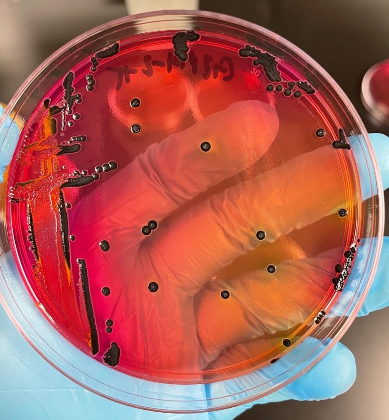 Salmonella colonies growing on red indicator plates. (Submitted photo)